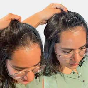hair topper in Noida